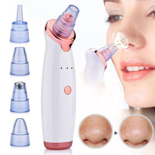 Facial Blackhead Vacuum (Pore Remover) (6875247214776)